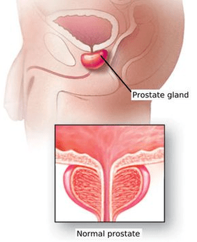 Schematischer Aufbau der männlichen Prostata